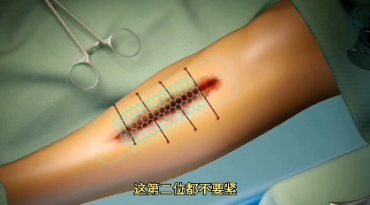骨折手術(shù)模擬器游戲手機(jī)版截圖1