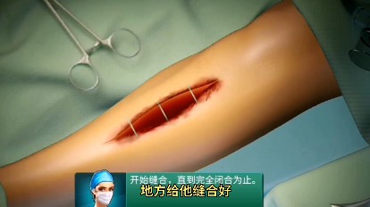 骨折手術(shù)模擬器游戲手機(jī)版截圖2