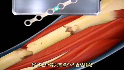 骨折手術(shù)模擬器游戲手機(jī)版截圖3