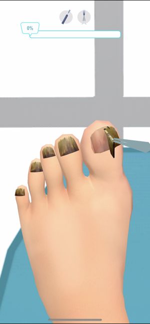 Foots Clinic游戲版截圖4