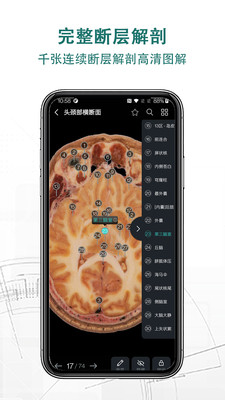 掌上3D解剖APP下載截圖5